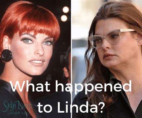 what happened to linda evangelista.